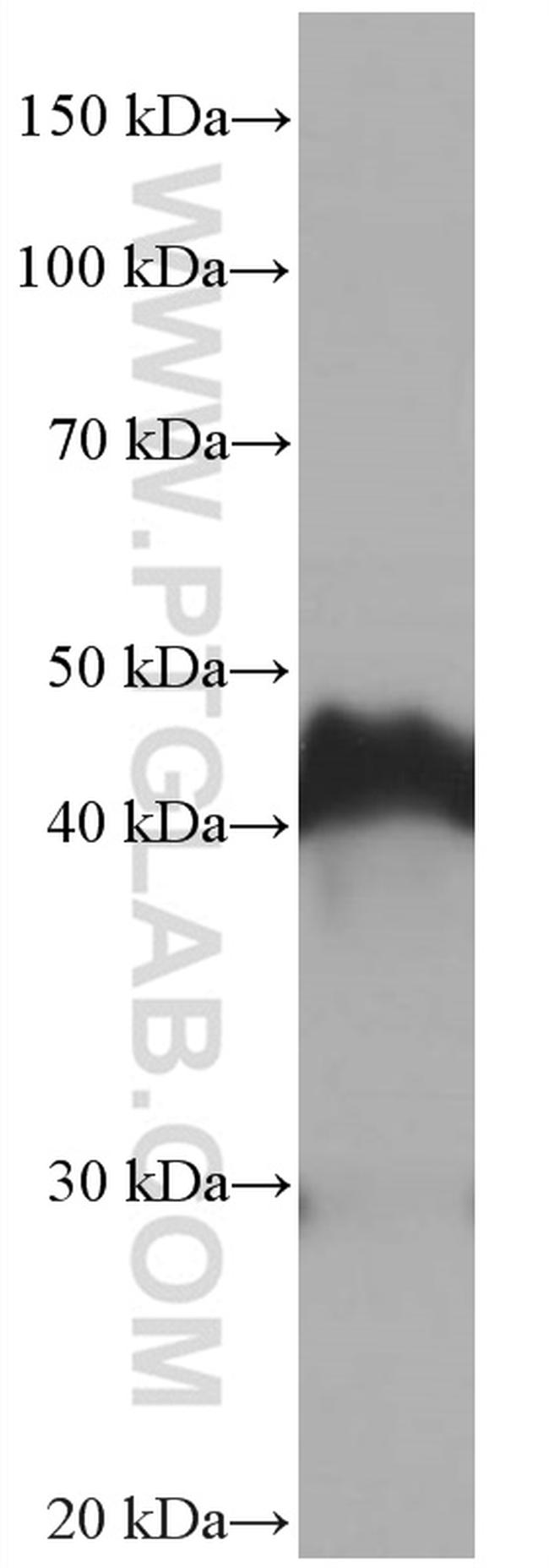 Dystroglycan Antibody in Western Blot (WB)