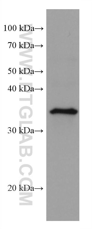 IL1 beta Antibody in Western Blot (WB)