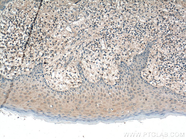 IL1 beta Antibody in Immunohistochemistry (Paraffin) (IHC (P))