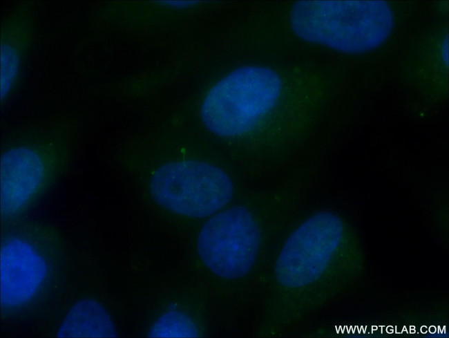 ARL13B Antibody in Immunocytochemistry (ICC/IF)