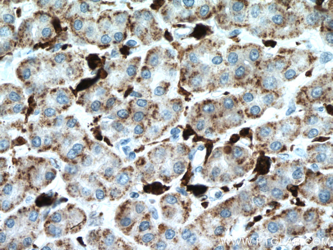 HO-1/HMOX1 Antibody in Immunohistochemistry (Paraffin) (IHC (P))