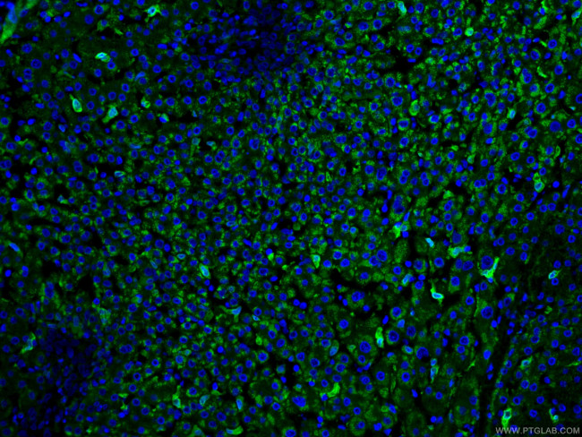 HO-1/HMOX1 Antibody in Immunohistochemistry (PFA fixed) (IHC (PFA))