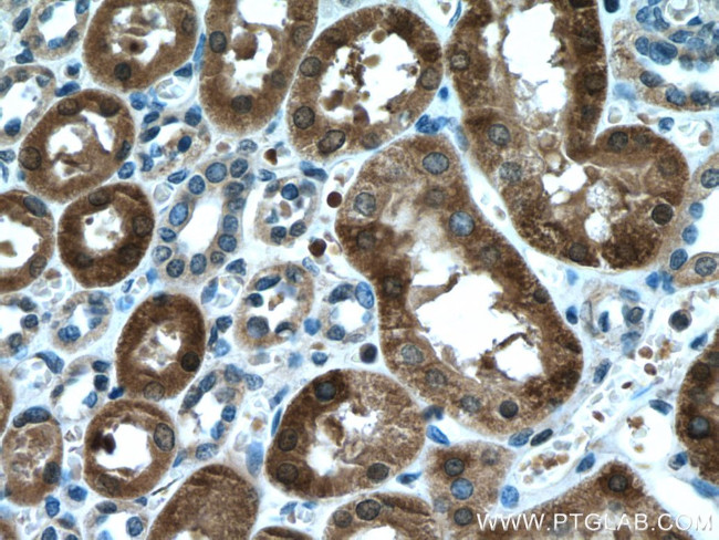 HO-1/HMOX1 Antibody in Immunohistochemistry (Paraffin) (IHC (P))