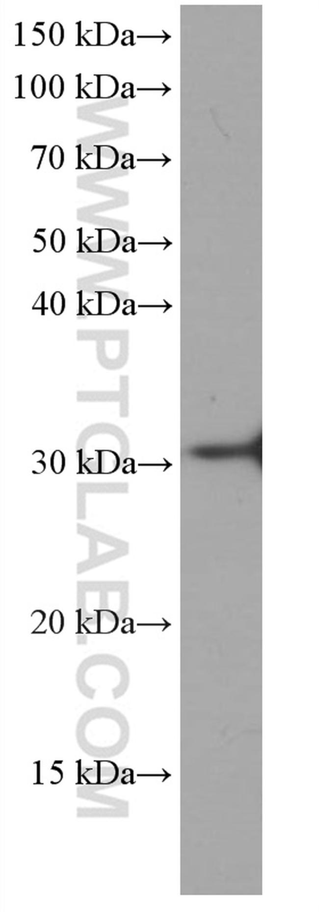 HO-1/HMOX1 Antibody in Western Blot (WB)