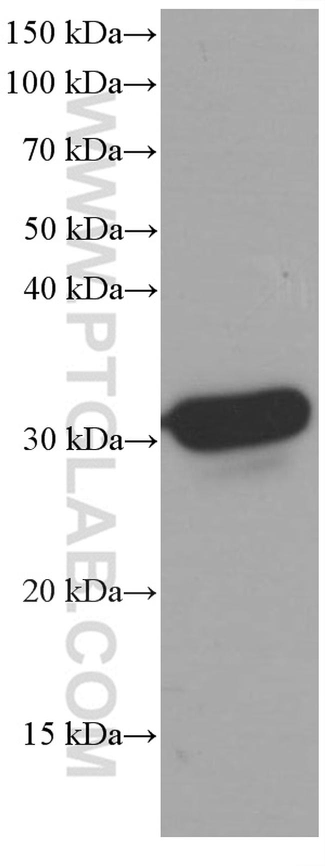 HO-1/HMOX1 Antibody in Western Blot (WB)