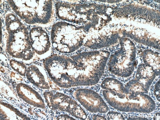 ATG5 Antibody in Immunohistochemistry (Paraffin) (IHC (P))