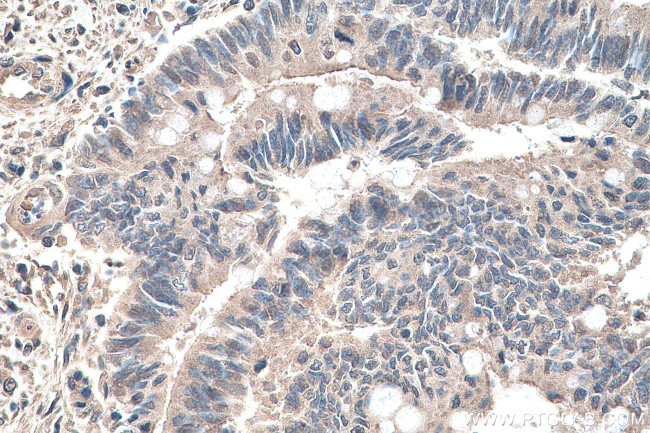 YTHDF1 Antibody in Immunohistochemistry (Paraffin) (IHC (P))