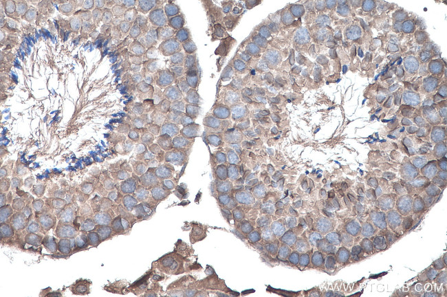 YTHDF1 Antibody in Immunohistochemistry (Paraffin) (IHC (P))