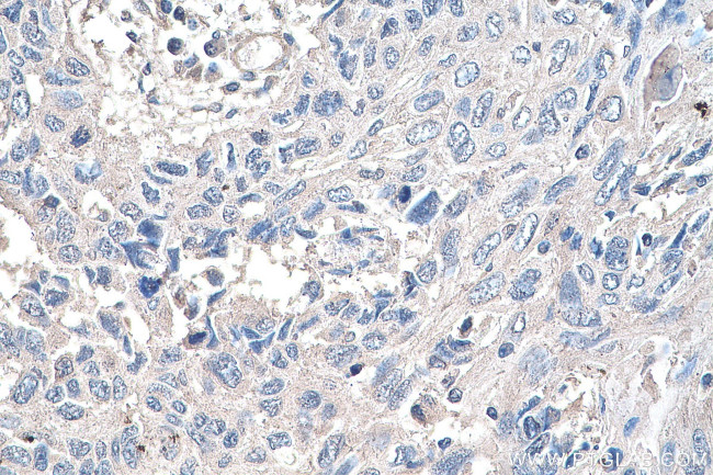 YTHDF1 Antibody in Immunohistochemistry (Paraffin) (IHC (P))