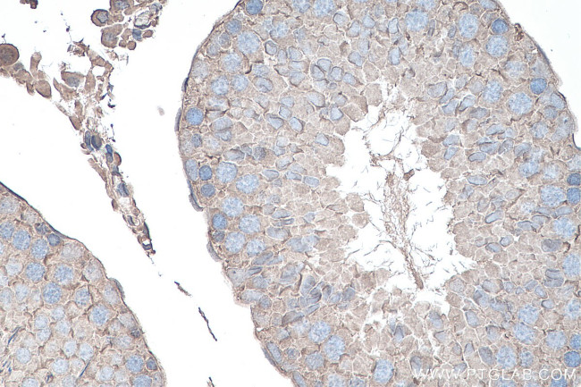 YTHDF1 Antibody in Immunohistochemistry (Paraffin) (IHC (P))