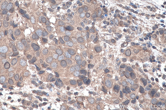 YTHDF1 Antibody in Immunohistochemistry (Paraffin) (IHC (P))