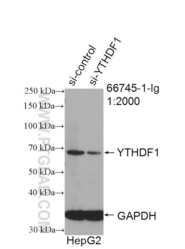 YTHDF1 Antibody in Western Blot (WB)