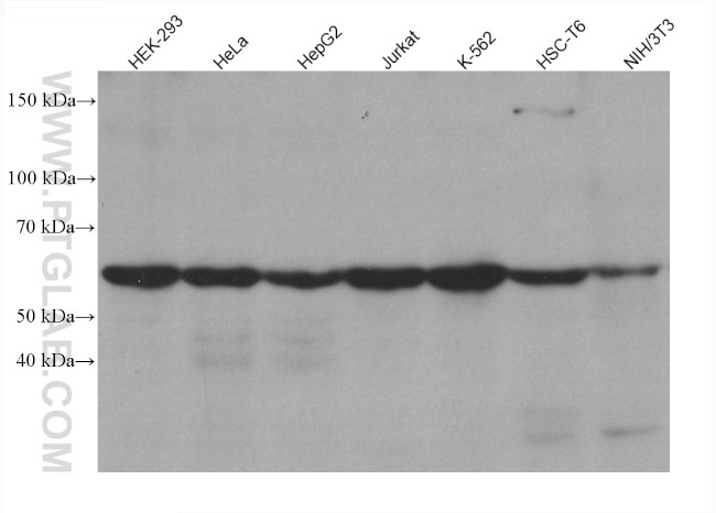 YTHDF1 Antibody in Western Blot (WB)