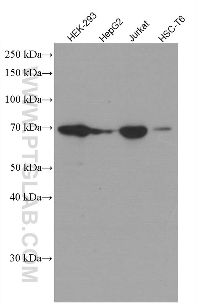 YTHDF1 Antibody in Western Blot (WB)