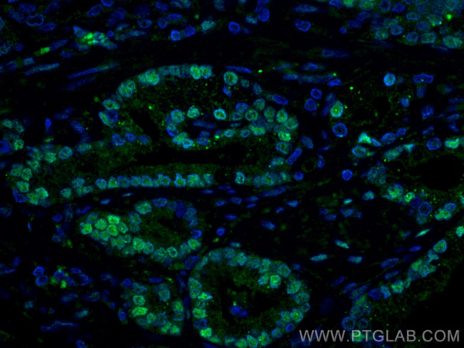 AR Antibody in Immunohistochemistry (PFA fixed) (IHC (PFA))