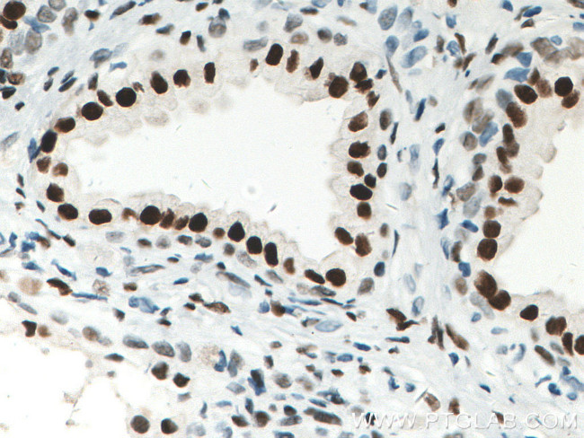 AR Antibody in Immunohistochemistry (Paraffin) (IHC (P))