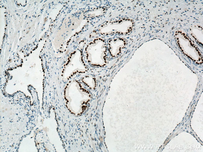 AR Antibody in Immunohistochemistry (Paraffin) (IHC (P))