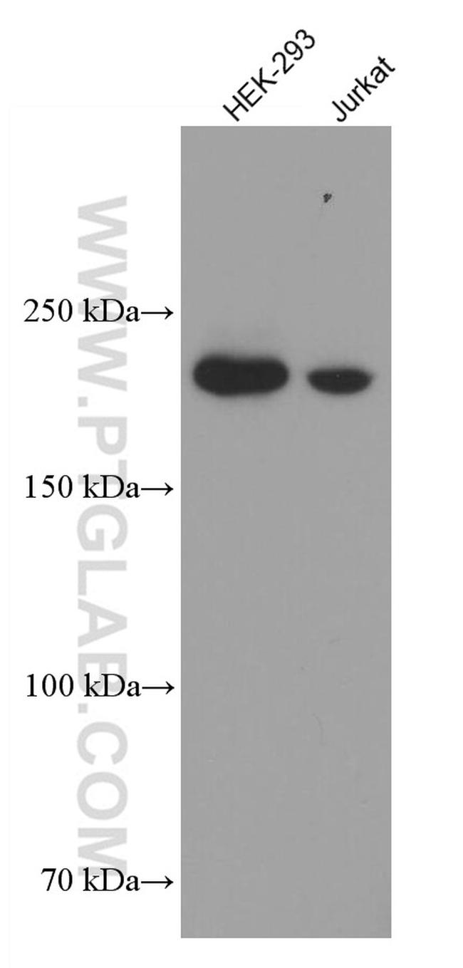 KIDINS220 Antibody in Western Blot (WB)