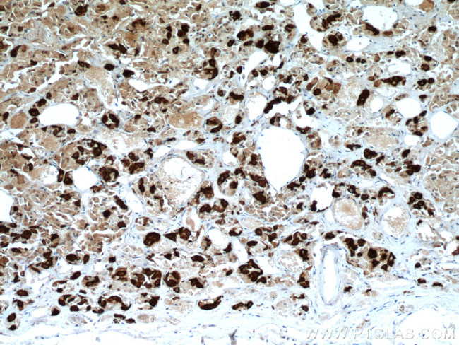 TSH beta Antibody in Immunohistochemistry (Paraffin) (IHC (P))