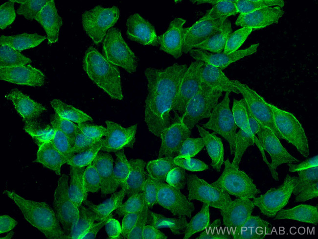 DR6 Antibody in Immunocytochemistry (ICC/IF)