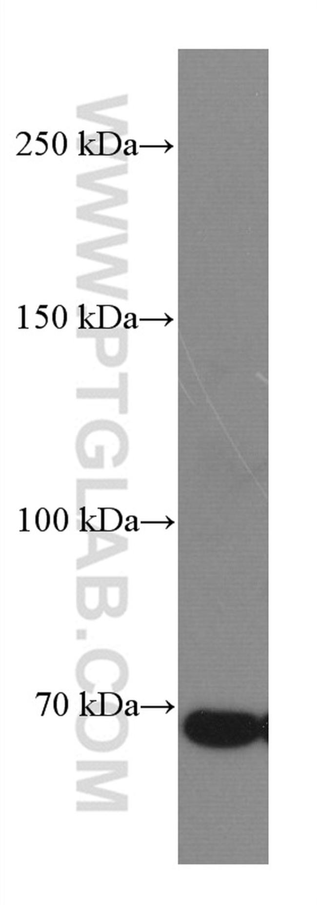 DR6 Antibody in Western Blot (WB)