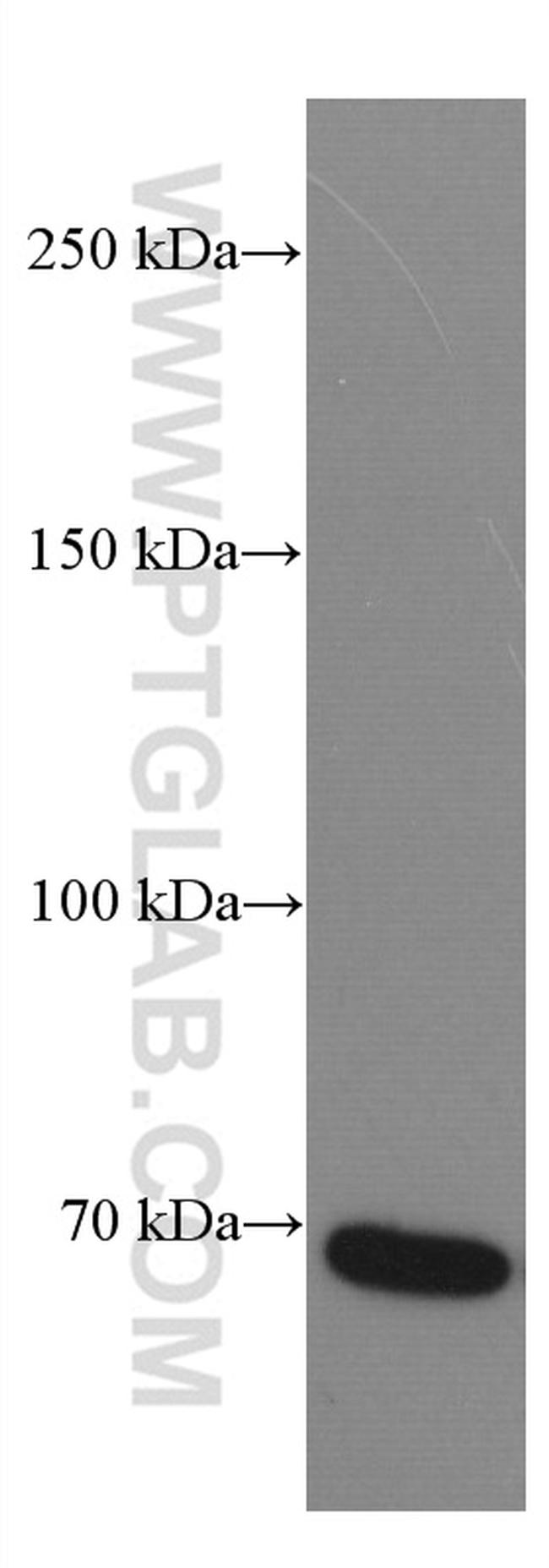 DR6 Antibody in Western Blot (WB)