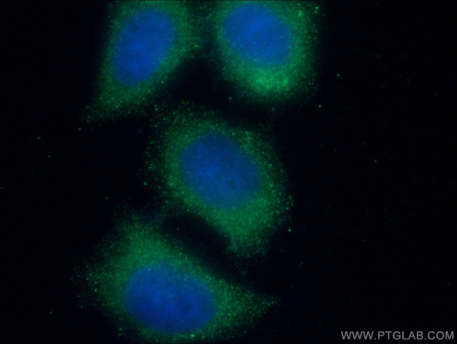 TRAF4 Antibody in Immunocytochemistry (ICC/IF)