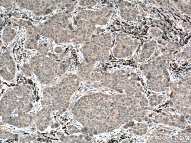 TRAF4 Antibody in Immunohistochemistry (Paraffin) (IHC (P))