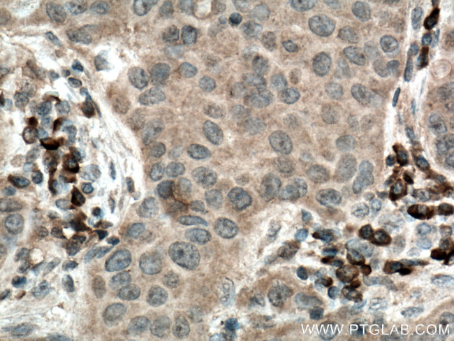 TRAF4 Antibody in Immunohistochemistry (Paraffin) (IHC (P))