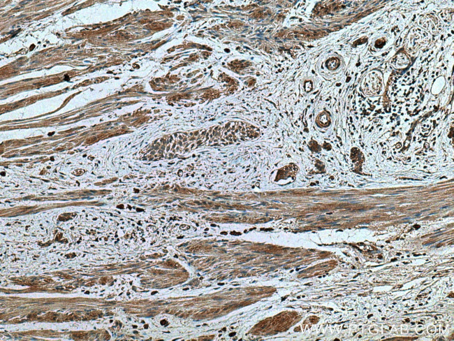 TRAF4 Antibody in Immunohistochemistry (Paraffin) (IHC (P))