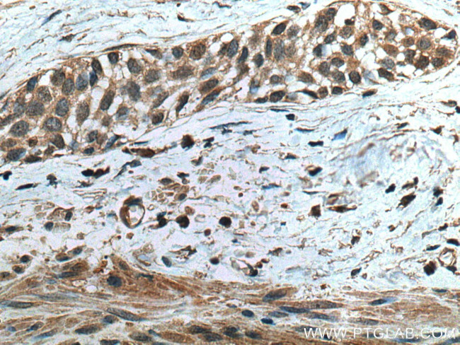 TRAF4 Antibody in Immunohistochemistry (Paraffin) (IHC (P))