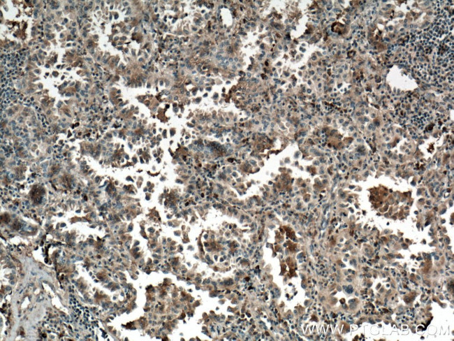 TRAF4 Antibody in Immunohistochemistry (Paraffin) (IHC (P))