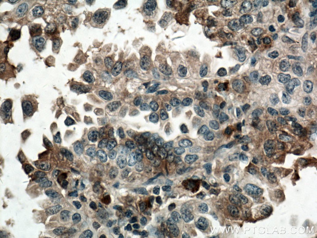 TRAF4 Antibody in Immunohistochemistry (Paraffin) (IHC (P))