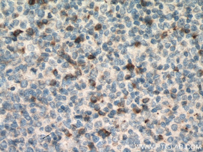 TRAIL Antibody in Immunohistochemistry (Paraffin) (IHC (P))