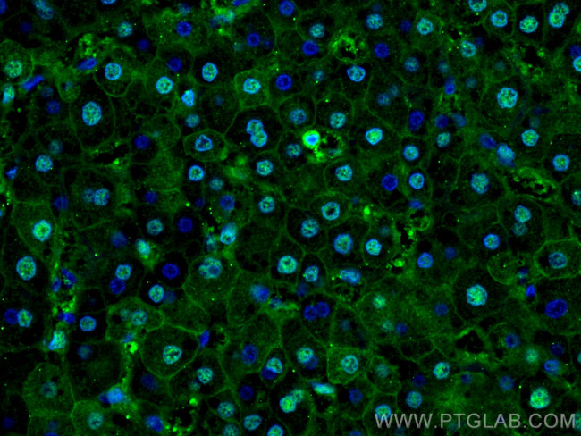 PSMB8 Antibody in Immunohistochemistry (PFA fixed) (IHC (PFA))