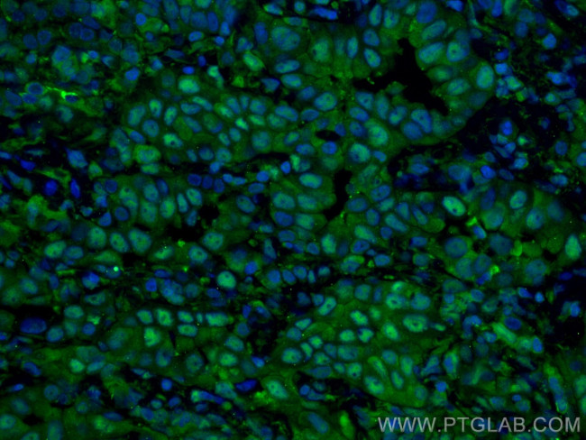 PSMB8 Antibody in Immunohistochemistry (PFA fixed) (IHC (PFA))