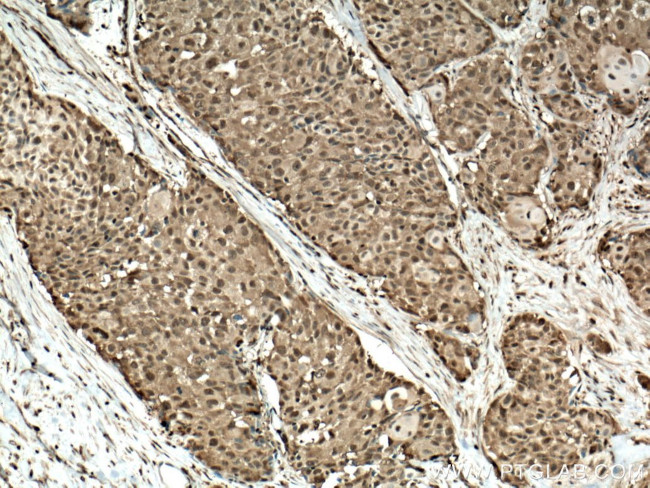 PSMB8 Antibody in Immunohistochemistry (Paraffin) (IHC (P))