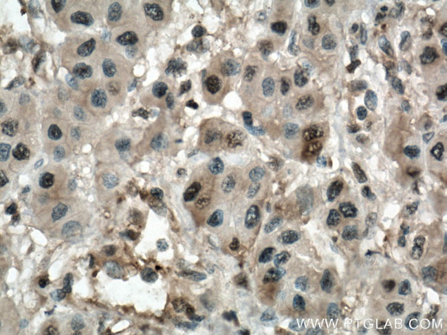 PSMB8 Antibody in Immunohistochemistry (Paraffin) (IHC (P))