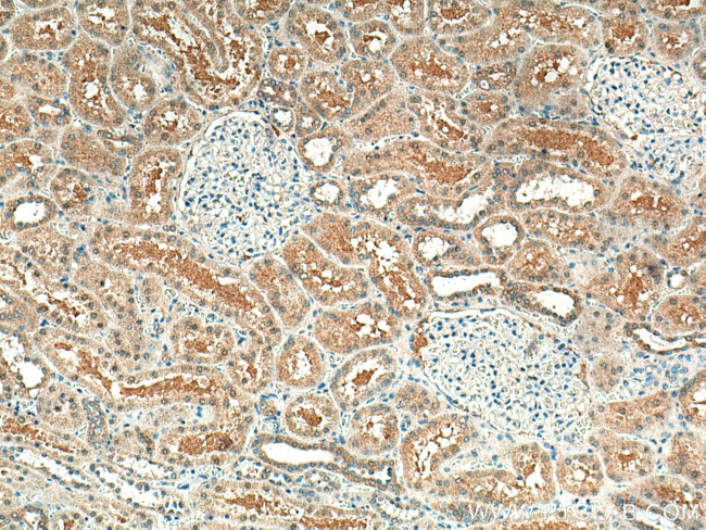 STX3 Antibody in Immunohistochemistry (Paraffin) (IHC (P))