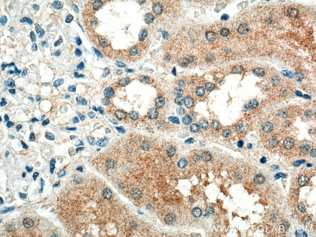 STX3 Antibody in Immunohistochemistry (Paraffin) (IHC (P))