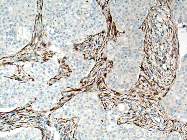 COL1A2 Antibody in Immunohistochemistry (Paraffin) (IHC (P))