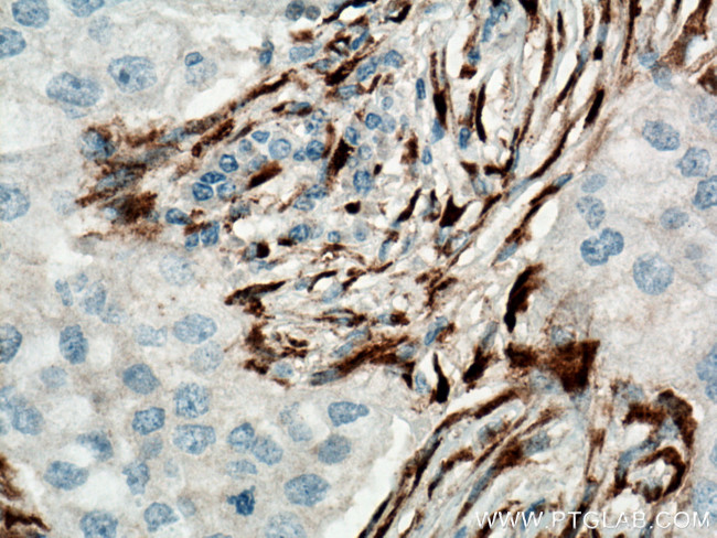 COL1A2 Antibody in Immunohistochemistry (Paraffin) (IHC (P))