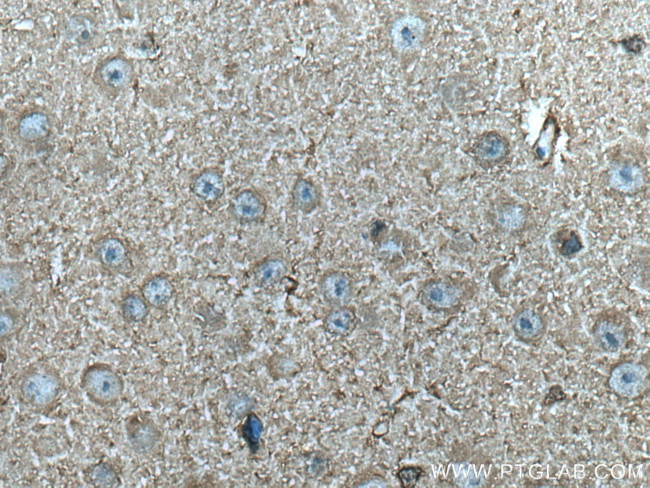 CKB Antibody in Immunohistochemistry (Paraffin) (IHC (P))