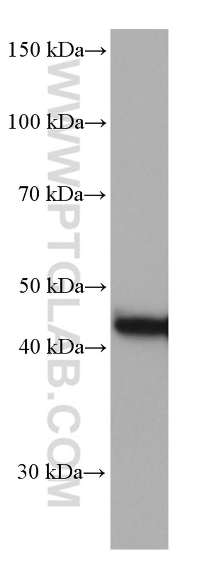 CKB Antibody in Western Blot (WB)