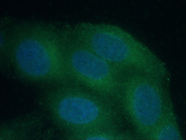 Catalase Antibody in Immunocytochemistry (ICC/IF)