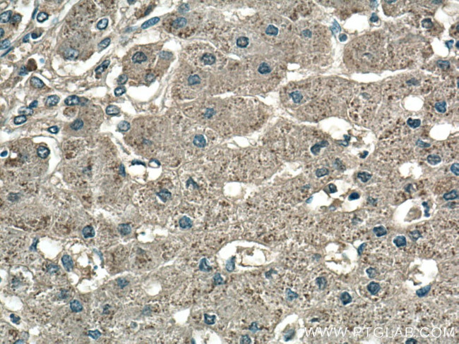 Catalase Antibody in Immunohistochemistry (Paraffin) (IHC (P))