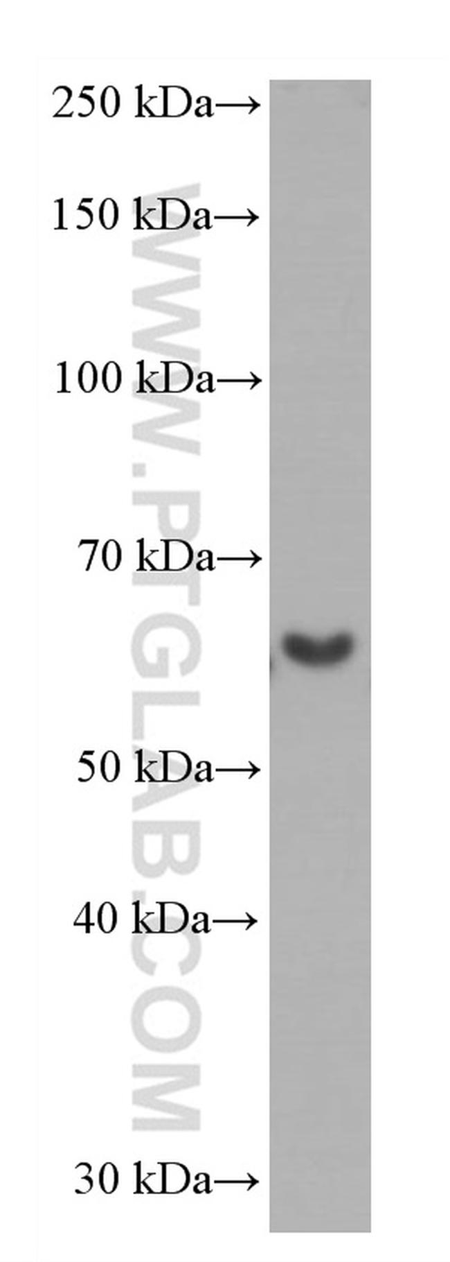 Catalase Antibody in Western Blot (WB)