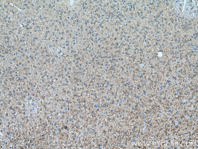 HSPB1 Antibody in Immunohistochemistry (Paraffin) (IHC (P))