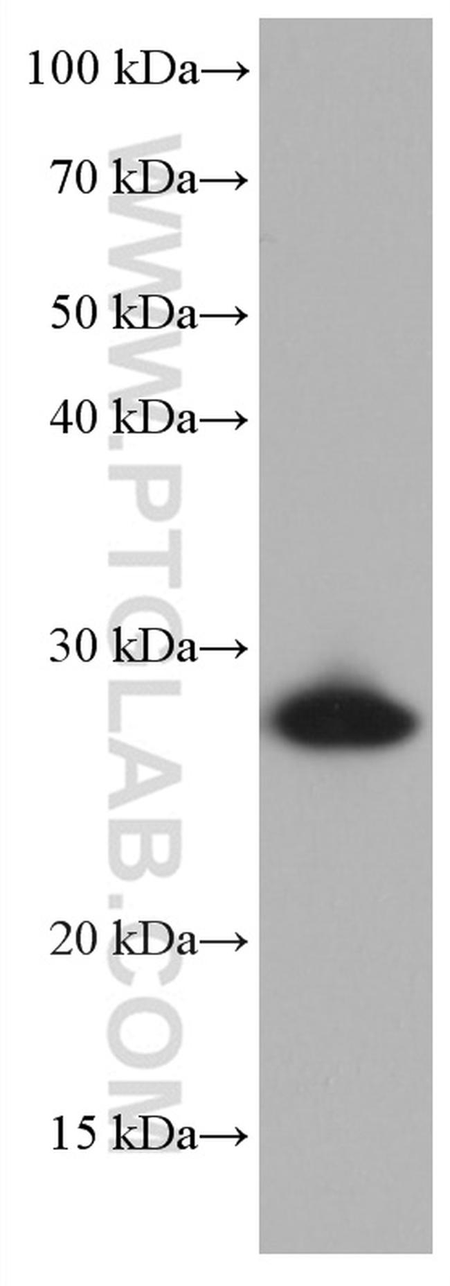 HSPB1 Antibody in Western Blot (WB)