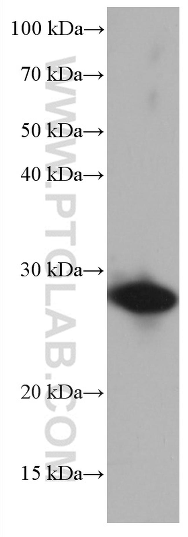 HSPB1 Antibody in Western Blot (WB)